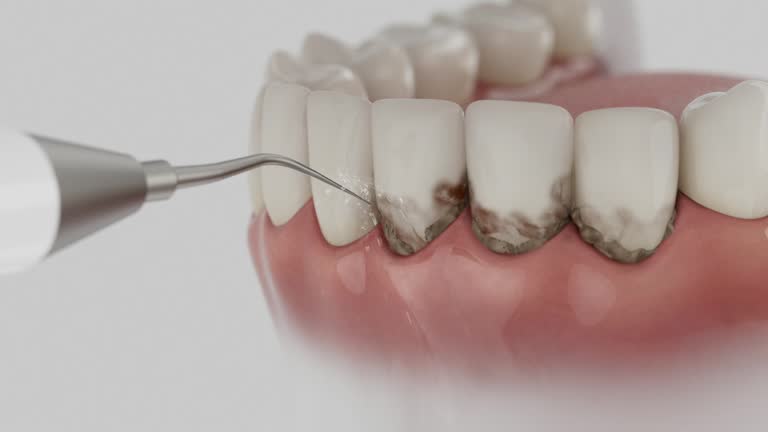 Reliable Tooth Extraction contractor in Clinch County County, GA by Dentist Open Now